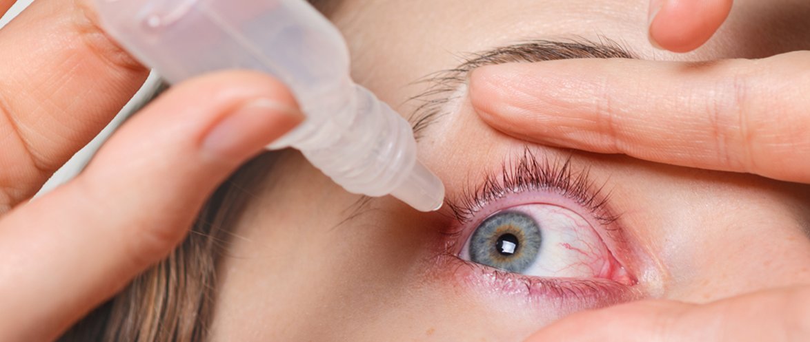 Как убрать покраснение глаз | Люксоптика