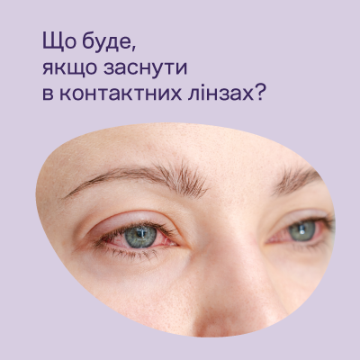 Можно ли спать в линзах: что разрешено и какие риски
